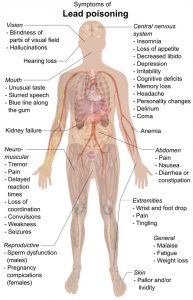 Symptoms_of_lead_poisoning